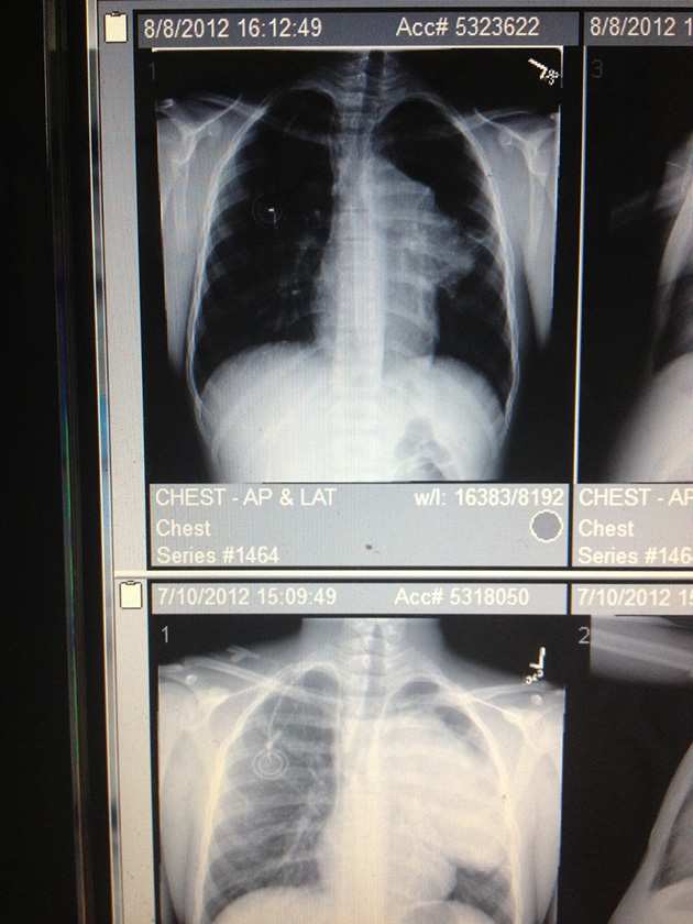 Comparisons of Edler's two MRIs.